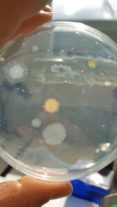 Exempelbild på odlingsbara mikroorganismer.